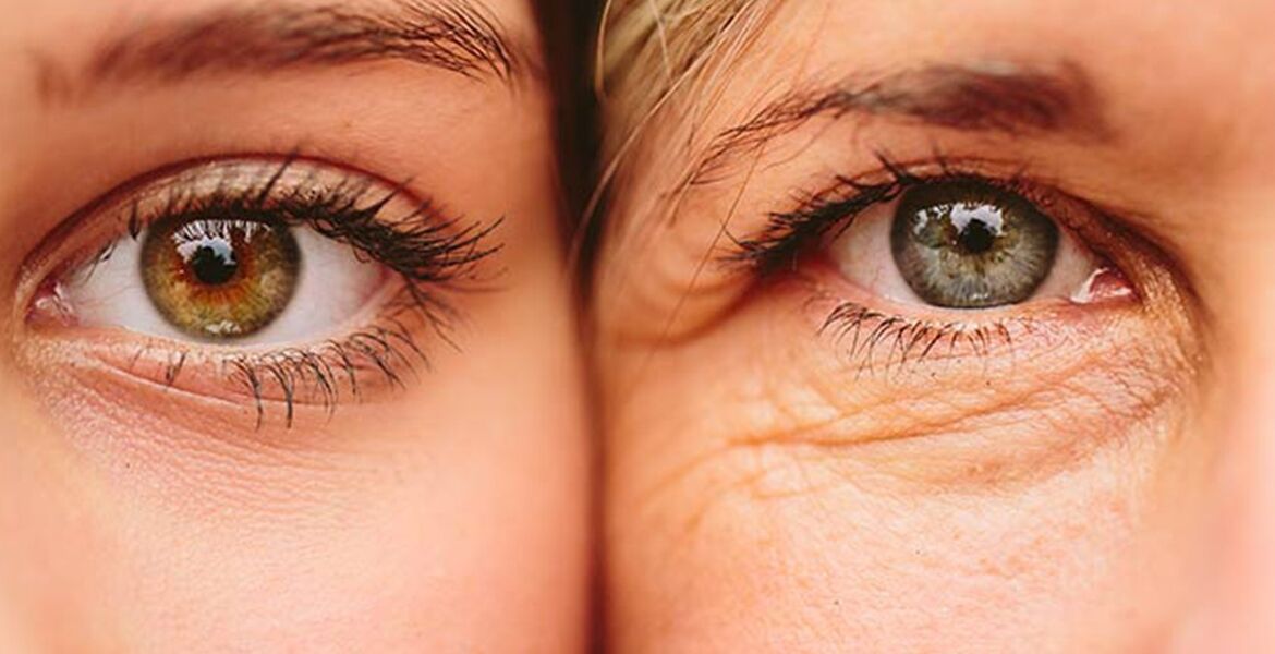Vonkajšie príznaky starnutia pokožky okolo očí u dvoch žien rôzneho veku